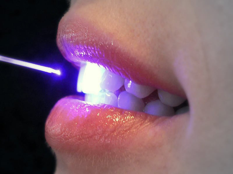 Diş Hekimliğinde Diyot Lazer Uygulamaları
